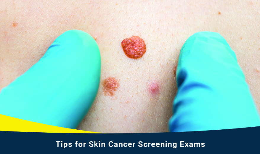 Tips for Skin Cancer Screening Exams